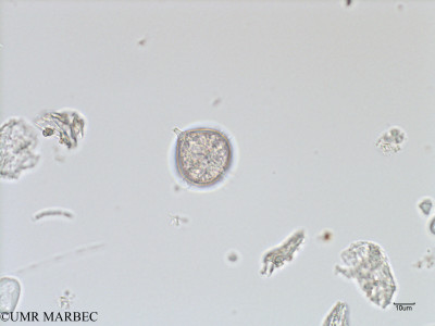 phyto/French_Polynesia/Arutua/ECOPE Janvier 2017/Protoperidinium cerasus (old P. pyriforme -sp2-C1A_S2R2_050117_Protoperidinium2-2).tif(copy)_thumb.jpg